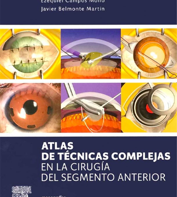Atlas de Técnicas Complejas en la Cirugía del Segmento Anterior