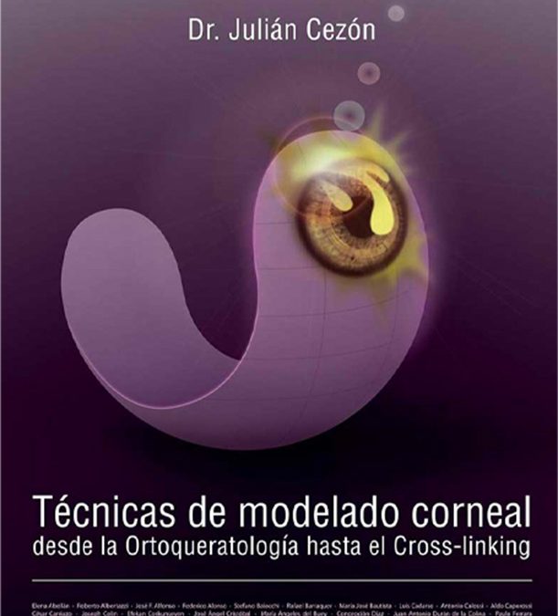 Técnicas de modelado corneal desde la ortoqueratología hasta el cross-linking