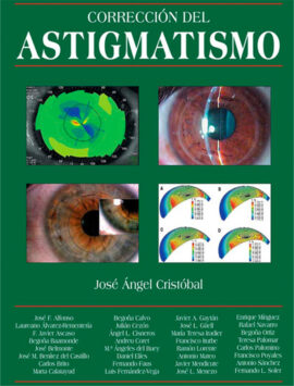 Corrección del astigmatismo