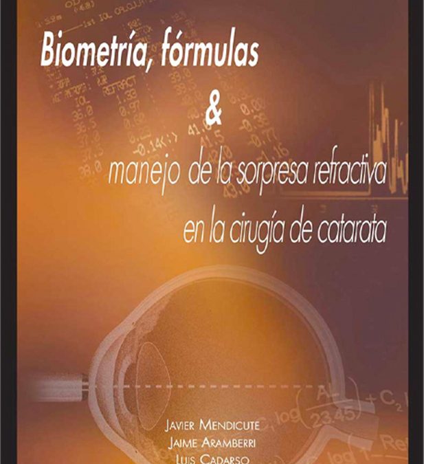 Biometría, fórmulas & manejo de la sorpresa refractiva en la cirugía de catarata