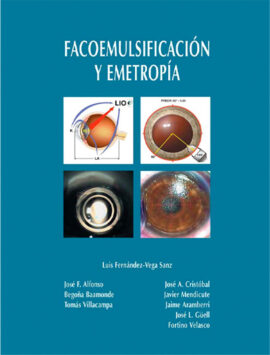 Facoemulsificación y emetropía