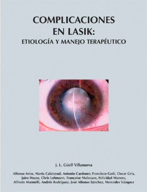 Complicaciones en LASIK: Etiología y Manejo Terapéutico